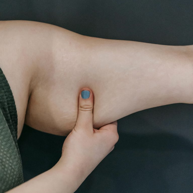problème peau sous les bras lifting